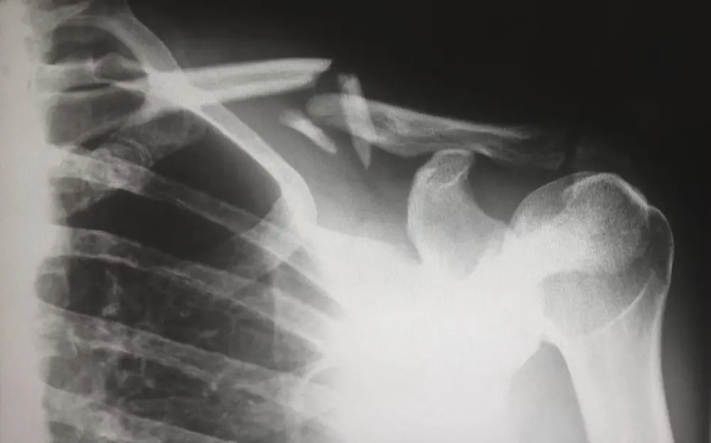 Radiografia em negatoscópio — imagem ilustrativa do raio-X feito na Clínica Veterinária Quatro Patas, em São Carlos